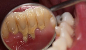 Cirugía oral 