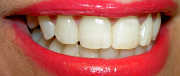 Odontología preventiva y conservadora